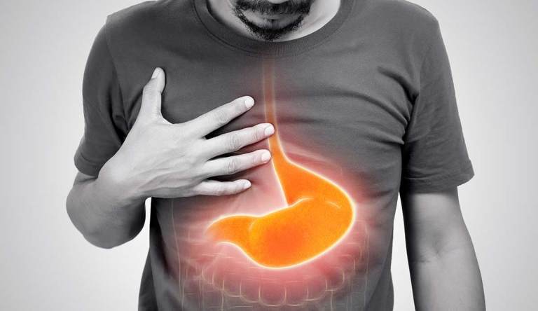 Severe Heartburn: Symptoms, Causes, Risk Factors and Treatment